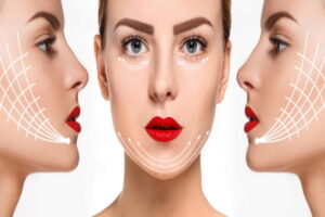 chirurgie esthétique pas cher