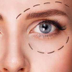 blepharoplastie en tunisie