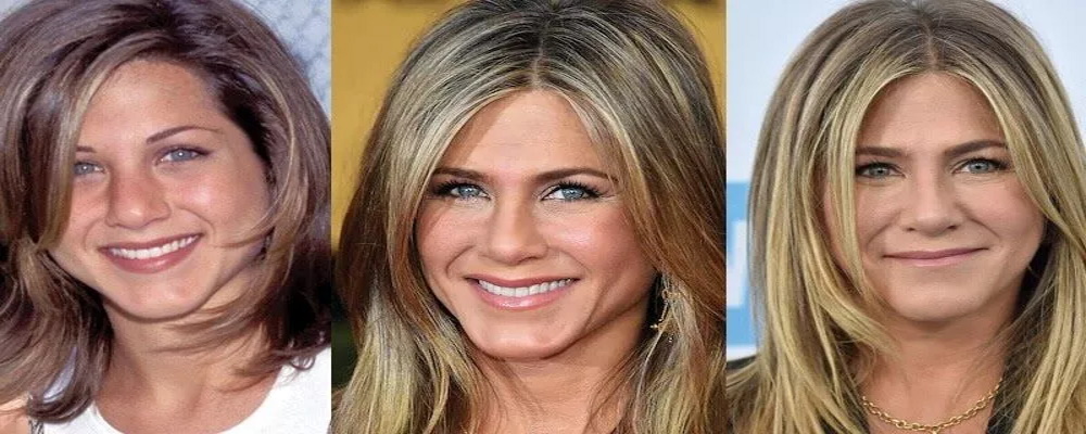 Jennifer Aniston Avant/après la chirurgie esthétique