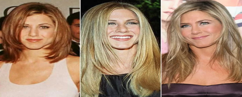 Jennifer Aniston après la chirurgie esthétique