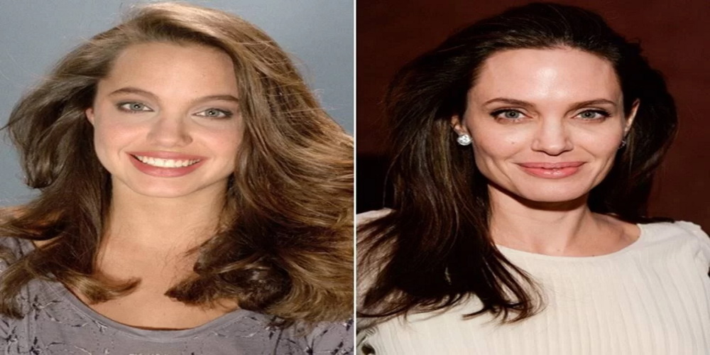 Angelina Jolie a-t-elle vraiment eu recours à la chirurgie esthétique ?
