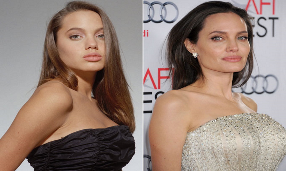 angeline jolie rhinoplastie