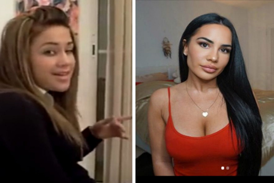 Milla Jasmine avant après chirurgie esthétique