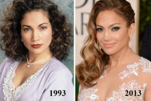 jennifer lopez chirurgie