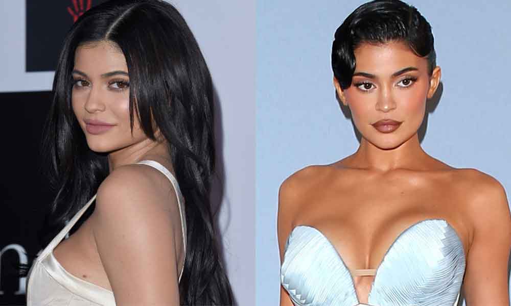 kylie jenner avant apres