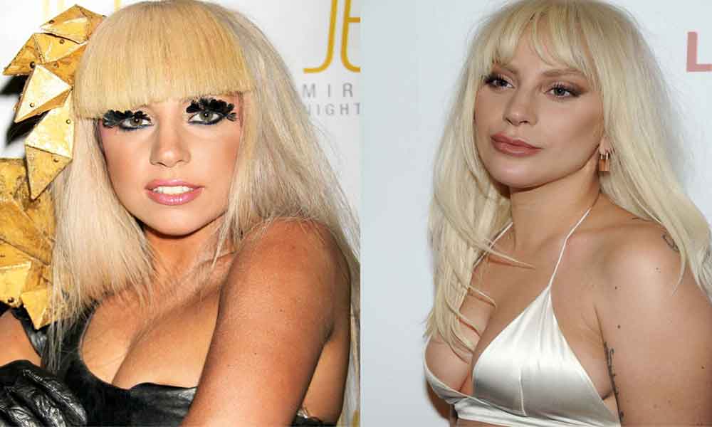 rhinoplastie lady gaga avant apres