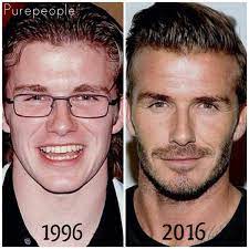 David Beckham avant après 