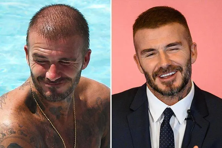 David Beckham avant après 