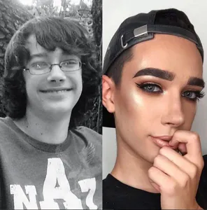 James Charles avant /apres