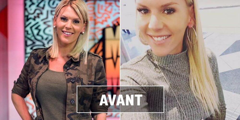 Amelie Neten avant/après la chirurgie esthétique 